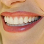 biocompatible-dentistry