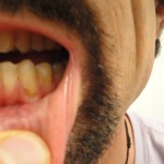 raw food teeth