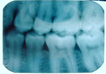 CancerandOtherIllnesses DentalRisk 21