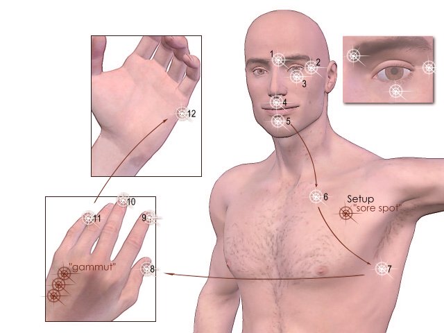 Using EFT on Paranoid Schizophrenia